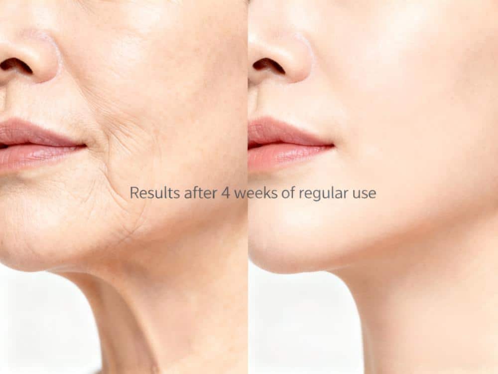 red light therapy before and after