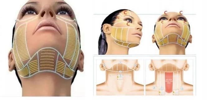 HIFU treatment machine body treatment parts
