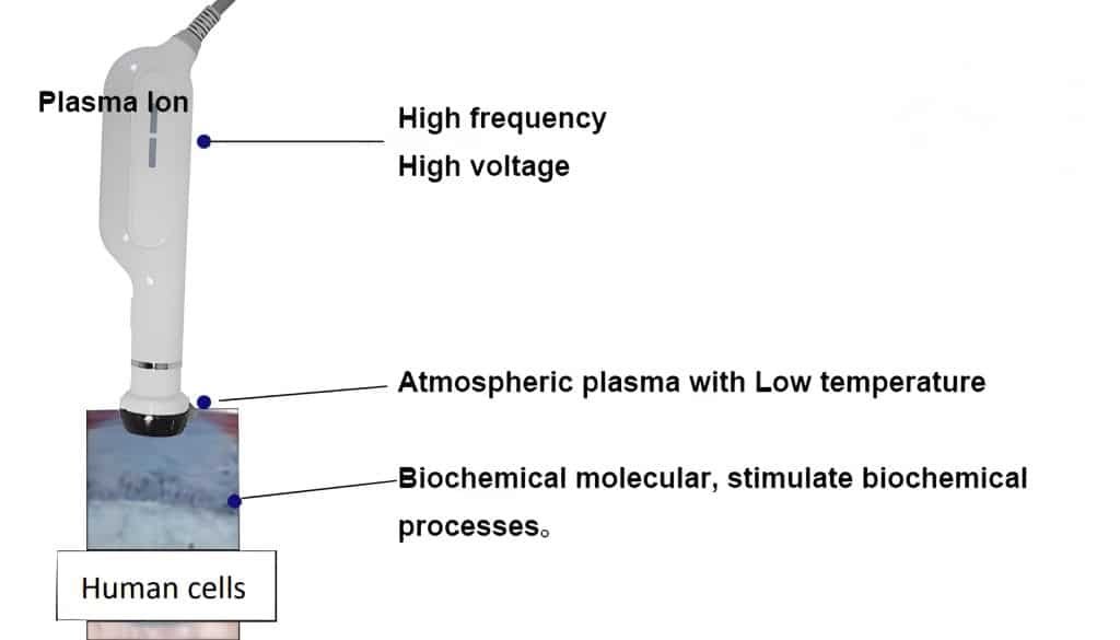 Plasma principle
