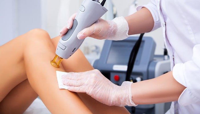Toepassingsbereiken van alexandriet nd yag laser