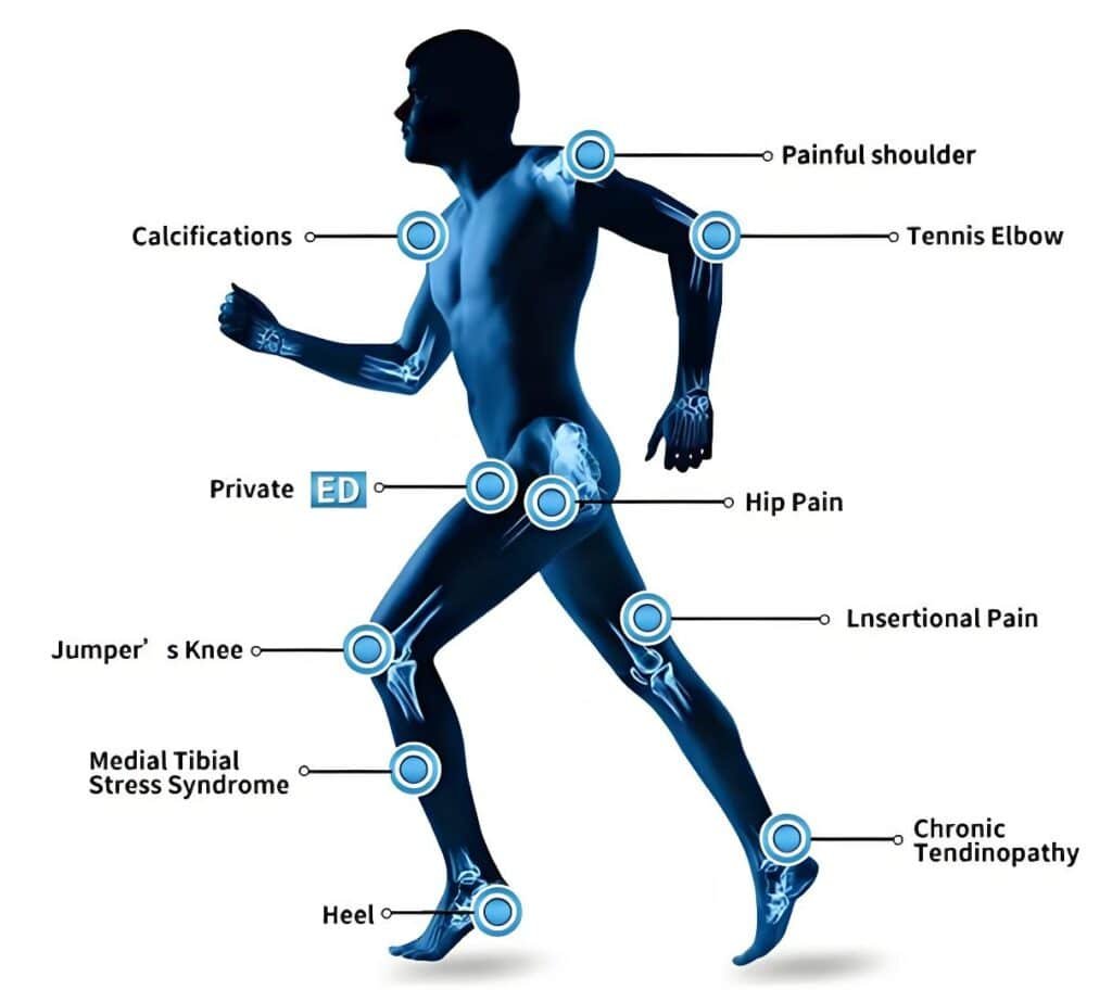 How PEMF Therapy Works