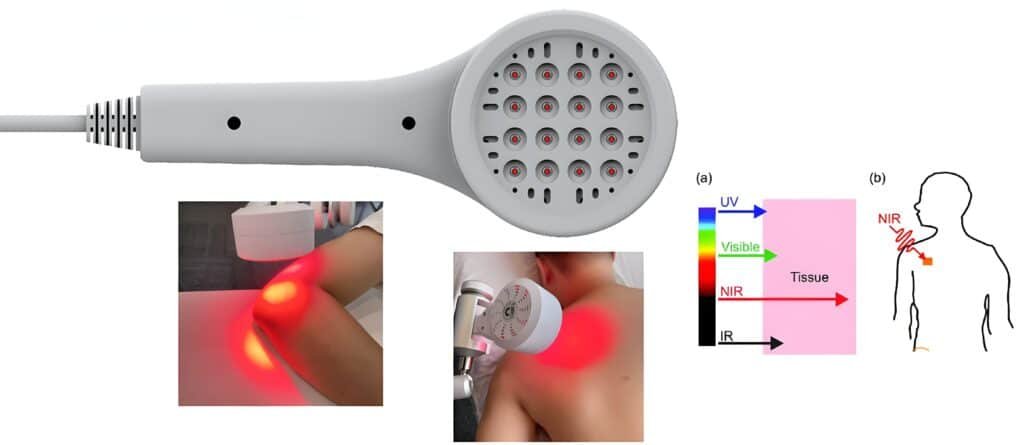 How does cold diodo laser therapy work